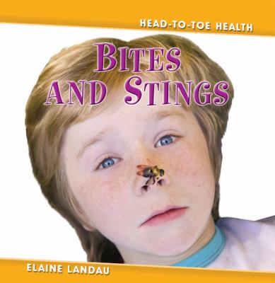 Bites and stings