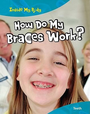 How do my braces work?