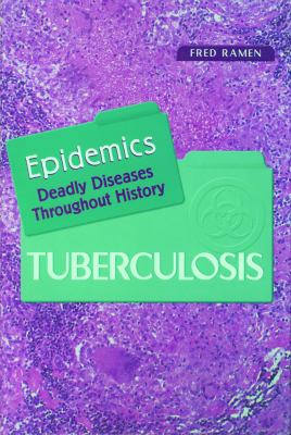 Tuberculosis